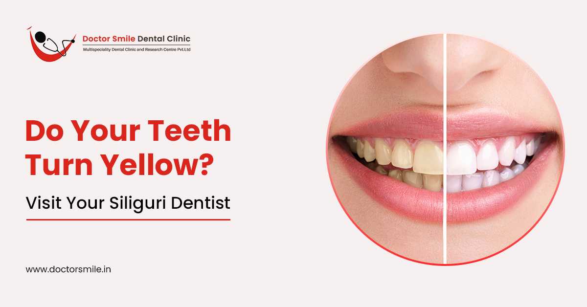 Do Your Teeth Turn Yellow? Visit Your Siliguri Dentist