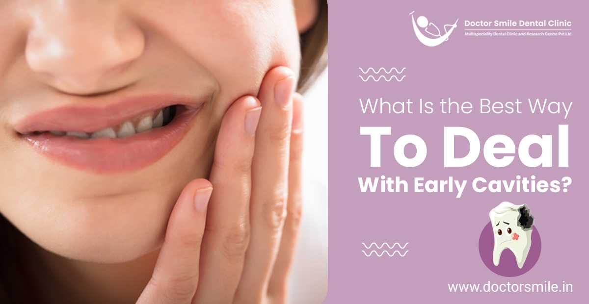 What is the Best Way to Deal with Early Cavities?