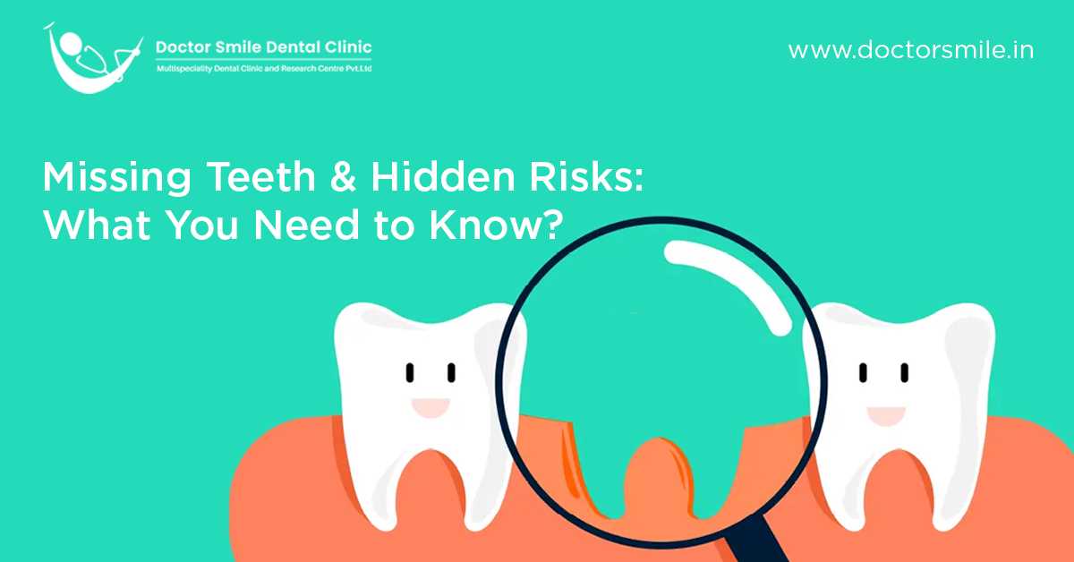 Missing Teeth And Hidden Risks: All You Need to Know