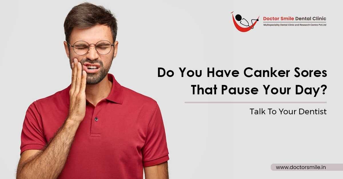 Do You Have Canker Sore That Pause Your Day? Talk To Your Dentist