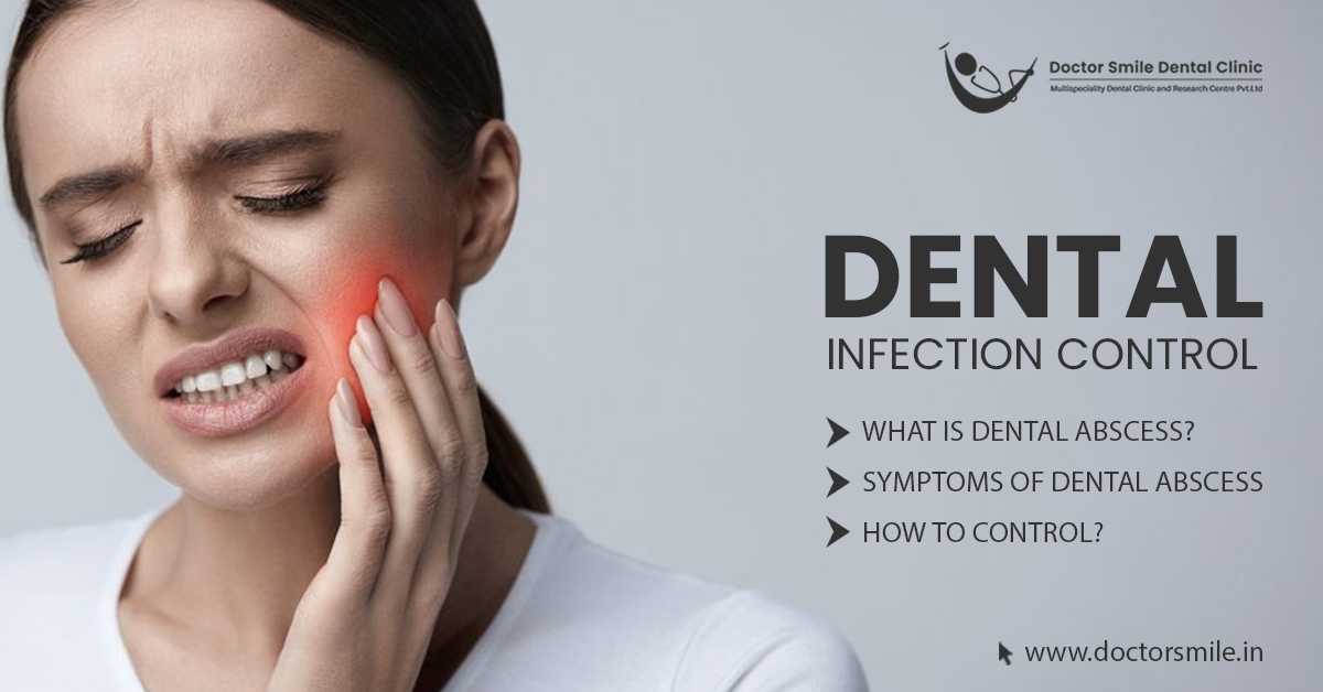 Dental Infection Control