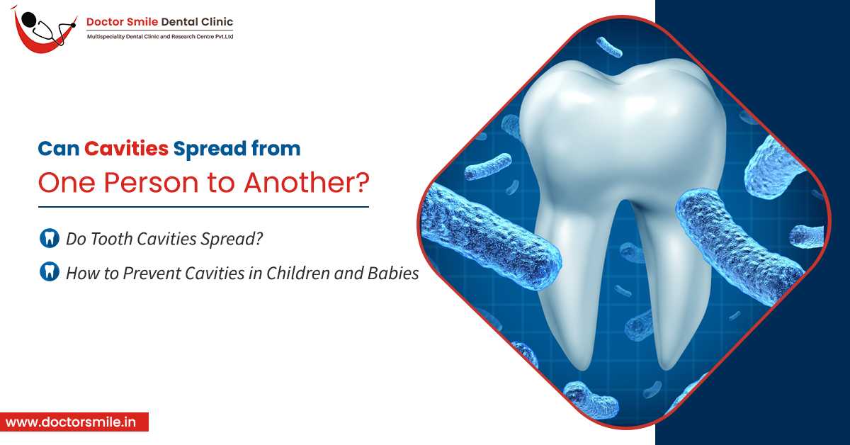 Can Cavities Spread From One Person to Another?