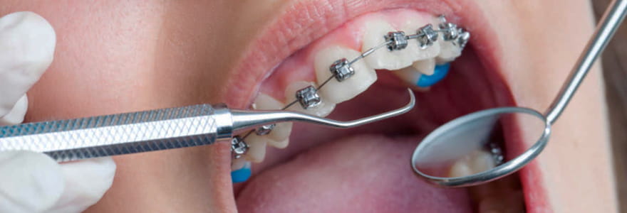 Orthodontics